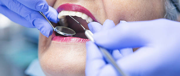 Best Emergency Denture Repair in Walce, LA
